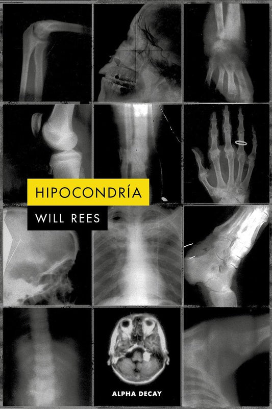 HIPOCONDRIA